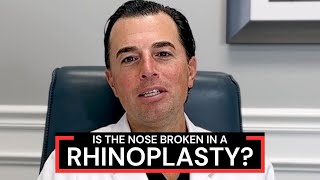 What is Osteotomy During Rhinoplasty Nose Job Surgery  Dr Anthony Corrado [upl. by Delora]