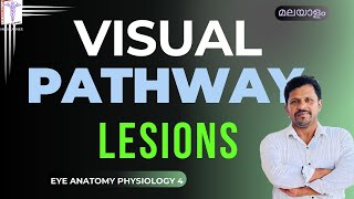 Visual Pathway Physiology Malayalam Lesions of visual pathway malayalam Visual Pathway Malayalam [upl. by Wright]