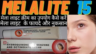 melalite cream use in hindi मेला लाइट क्रीम का उपयोग कैसे करें how to use melalite 15 side amp effects [upl. by Yellhsa110]