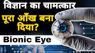 पूरा आँख बना दिया  World’s first bionic eye brings hope for blindness [upl. by Ahsuatan201]