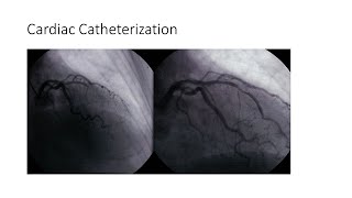 Cardiac Catheterization [upl. by Ybab]