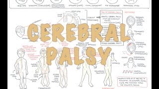 Cerebral Palsy  DETAILED Overview [upl. by Adelheid]