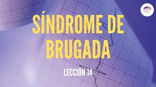 14 SÍNDROME DE BRUGADA ELECTROCARDIOGRAFÍA [upl. by Disario]