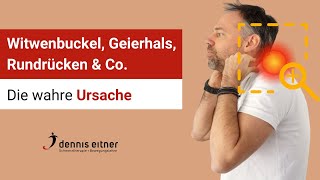 Schmerzen an der Halswirbelsäule verstehen und beseitigen  Witwenbuckel Geierhals und Rundrücken [upl. by Arrec55]