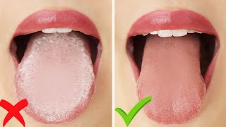 Tongue Rejuvenation The ANSWER to Fixing Chronic Bad Breath amp Halitosis [upl. by Sidnarb]