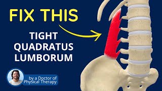 Is a Tight QL Causing Your Back Pain  Quadratus Lumborum Muscle Tightness [upl. by Weissberg]