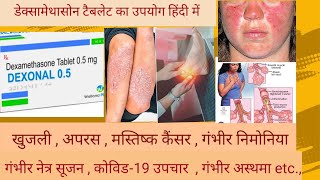 Dexamethasone tablets uses in Hindi  Dosage  Side effects  contraindications  Drugs interactions [upl. by Rhody472]