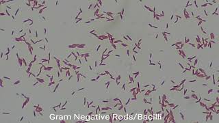 Gram Negative Rods under the Microscope at various magnification [upl. by Azila]