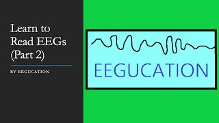 Learn to Read EEGs Part 2 [upl. by Brindle]