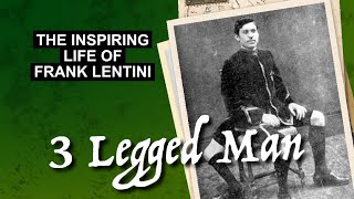 The Inspiring Life of Frank Lentini [upl. by Yffub657]