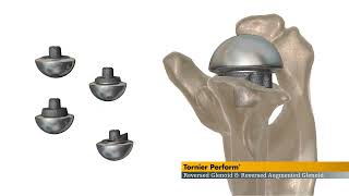 Tornier Perform Reversed Glenoids [upl. by Wye]
