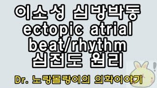 ectopic atrial beatrhythm이소성 심방박동리듬 심전도ecg coronary sinus rhythm과 left atrial rhythm [upl. by Benedix372]