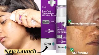 The Derma Co TranZelaic Pigmentation Corrector Serum Review  Treats Hyper Pigmentation amp Melasma [upl. by Geri]