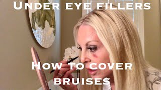 😱 UNDER EYE FILLER  HOW I COVER A BRUISE  The Style Chase [upl. by Swithbert]