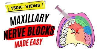 Maxillary Nerve Block Anesthesia For Dental Procedures [upl. by Yruj]