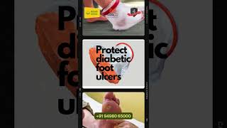 Protect Your Diabetic Foot Ulcer with Our Waterproof Cover [upl. by Belter]