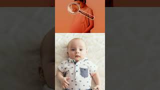 Nose changes during pregnancy  trending ytshorts pregnancy viralvideo explore [upl. by Waldo416]