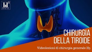 Chirurgia della tiroide [upl. by Breech627]