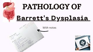 Barretts Dysplasia pathology  Features of Barretts Dysplasia  Gastrointestinal tract pathology [upl. by Neevan712]