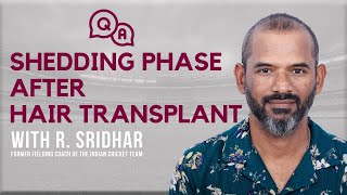 Shedding Phase After Hair Transplant Coach R Sridhars Take on Hair Transplant Shedding [upl. by Atilef]