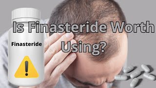 Finasteride For Hair Loss Is It Worth Using It Learn What You Need About Finasteride [upl. by Marten]