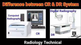 Difference between Computed Radiography CR  amp Digital Radiography  DR    By BL Kumawat [upl. by Aric660]