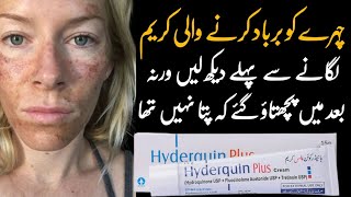 hydroquinone plus cream  hydroquin plus cream uses  hydroquin plus tube  side effects in Urdu [upl. by Adolphus266]