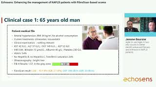 FibroScan®based Scores in NAFLD patient management [upl. by Neerod]