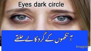 dark circle eyes dark circle  ankhoon ky girth siah halky  herbalist Ishaq farrukh [upl. by Adnilym]