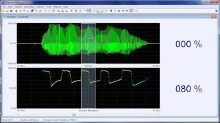 Measuring nasality with the Nasality Microphone [upl. by Ahsela491]