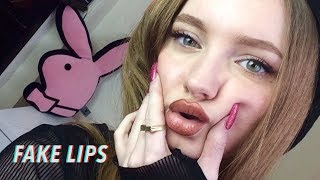 I GOT LIP FILLERS  My Experience video footage [upl. by Ssew]