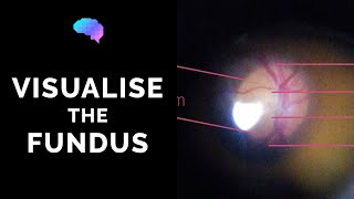 Fundoscopy  How to Visualise the Fundus  Direct Ophthalmoscopy  OSCE Guide  UKMLA  CPSA [upl. by Aekan749]