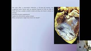 HEMODYNAMIC DISORDES CASES PART TWO  HARD DISEASES CASES PART 1 [upl. by North752]