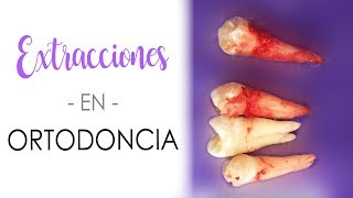 En 🔴 VIVO Extracción de PREMOLAR INFERIOR para ortodoncia Brackets ¡Como sacar un diente 45 sg [upl. by Koerner733]