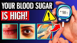 10 WARNING Signs Your Blood Sugar Is High [upl. by Lilak]