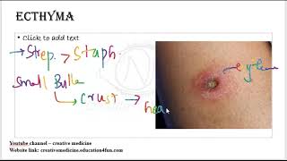 3 4 ecthyma mp4  Dermatology [upl. by Georgeanna]