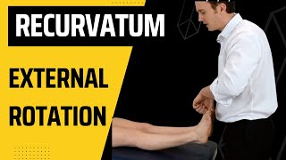 How to do the External Rotation Recurvatum Test for the Knee [upl. by Boles683]