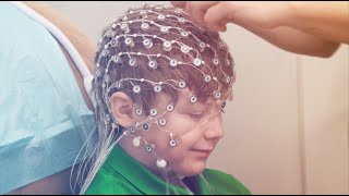 High Density HD EEG Testing Services [upl. by Villiers]