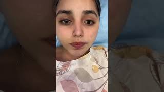 hydra facial benefits hydrafacial foryou multan [upl. by Drahsar]