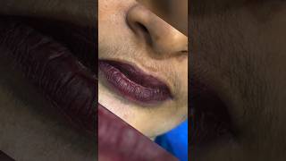 Upper lips waxing by rica brazilian wax waxing waxingathome waxingtips ricawax skincare beauty [upl. by Anelle272]