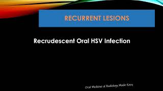 Recrudescent Oral Herpes Infection [upl. by Nibroc550]