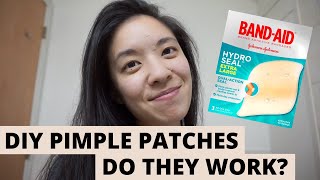 DIY Hydrocolloid Pimple Patches  Pimple Dots  Hydro Seal BandAid Review [upl. by Friedberg]