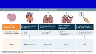 Connective tissue disease associated pulmonary hypertension Prof Mostafa Elshazly Chest Kasr ElAini [upl. by Dnamra]