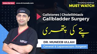 Gallstones  Cholelithiasis  Gallbladder Surgery  Everything explained MUST WATCH [upl. by Atteugram]