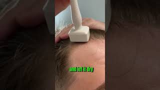 This Is How I Use My Derma Stamp To Increase My Hair Growth [upl. by Enaek]