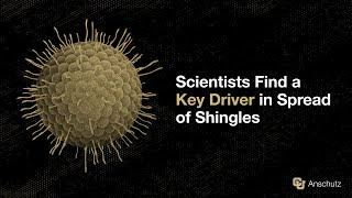 Scientists Find a Key Driver in Spread of Shingles [upl. by Eehtomit520]