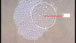 Revision Tp parasitologie n°4 [upl. by Deutsch108]