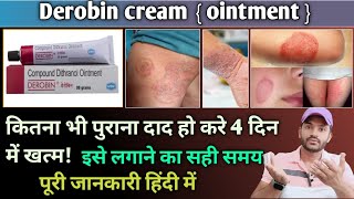 Derobin ointment cream use in hindi [upl. by Nueovas]