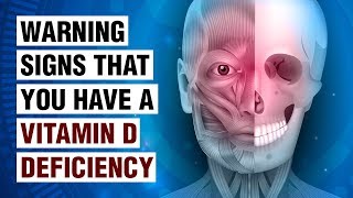 14 Signs Of Vitamin D Deficiency [upl. by Jensen]