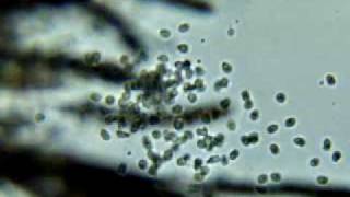 water mold zoospores [upl. by Persian]